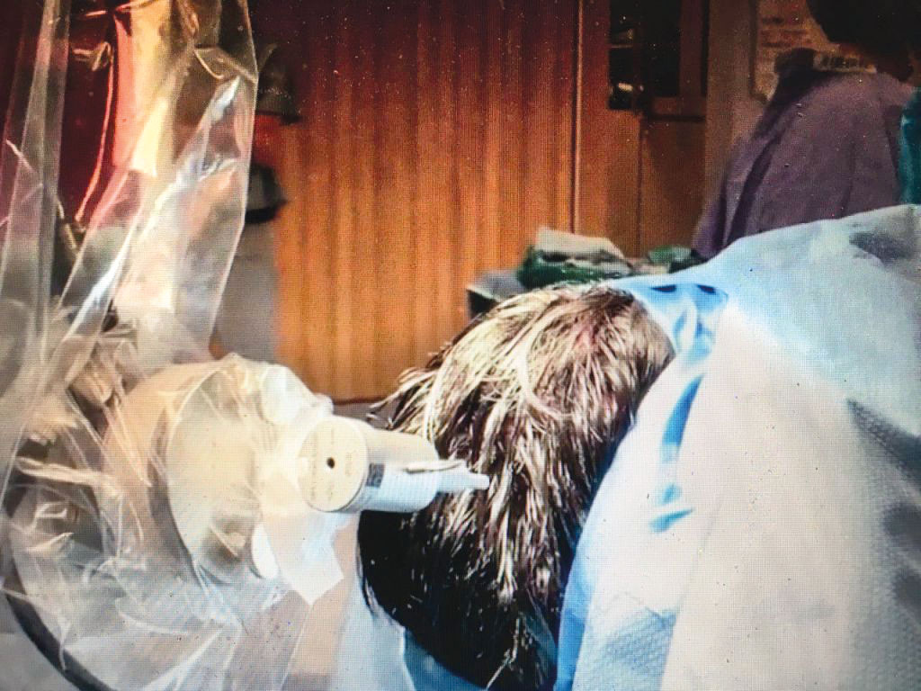 a man getting surgery on his head